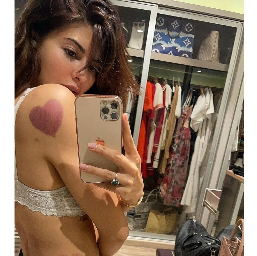 Jacqueline Fernandez drops gorgeous PHOTO post cupping session, fans call its mark a new TATTOO.